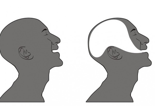 Dysarthria vs. Aphasia