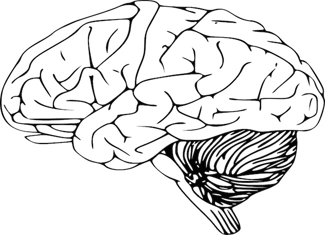 Aphasia and dysphasia